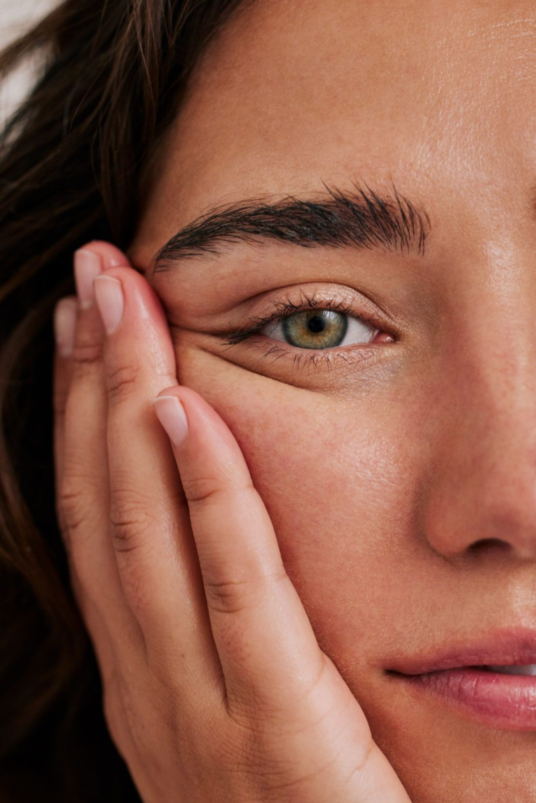 Natural Acne Remedies