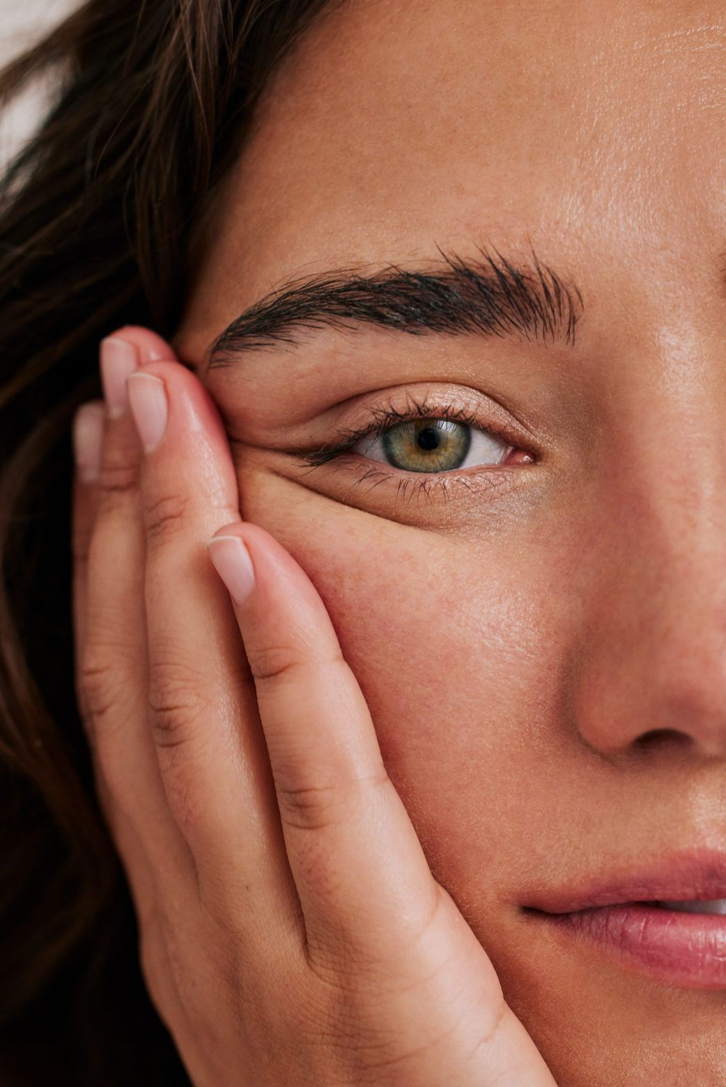 Natural Acne Remedies